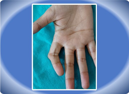 FINGER INJURY